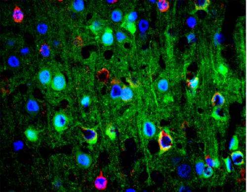 Scientist helps develop new tools to probe mysteries of the brain