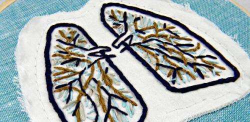Scientists grow ‘mini-lungs’ to aid the study of cystic fibrosis