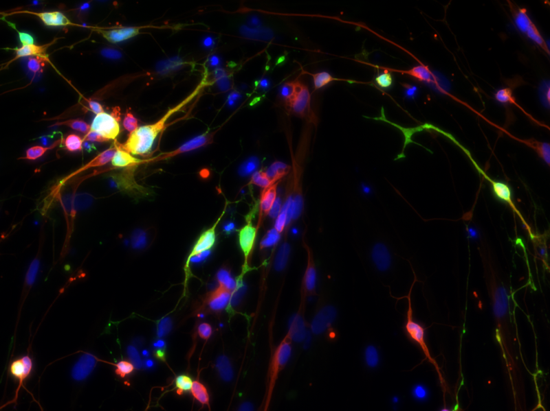 Scientists grow human serotonin neurons in petri dish
