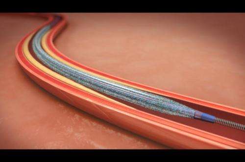Scripps offers new treatment for peripheral artery disease