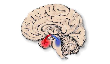 Seizures knock out brain arousal centers