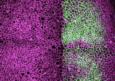 Skeleton of cells controls cell multiplication