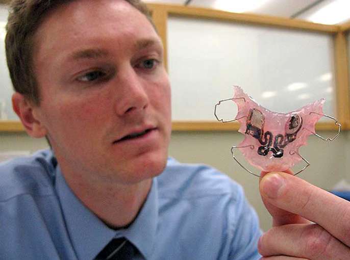 'Smart' retainer keeps patients (and teeth) in line