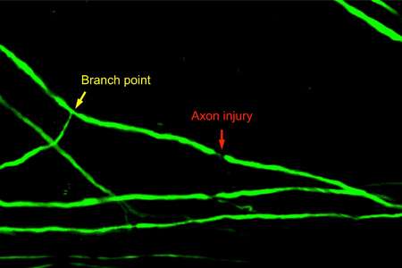 Spinal cord axon injury location determines neuron's regenerative fate