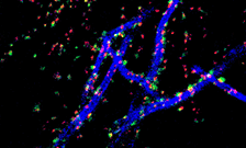 Static synapses on a moving structure: Mind the gap!