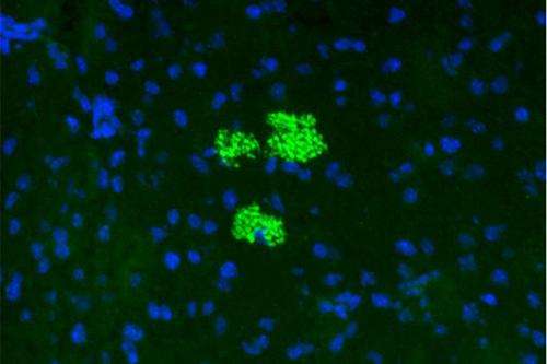 Steering stem cell trafficking into pancreas reverses type 1 diabetes