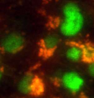 Stem cells lurking in tumors can resist treatment