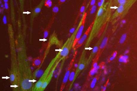 Stem cell technology could lead to ailing heart mending itself