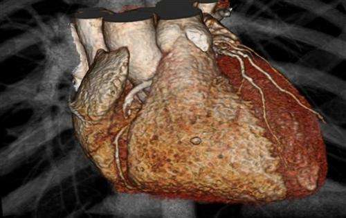 Study calls heart imaging into question for mild chest pain