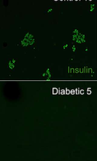 Study describes underlying cause of diabetes in dogs