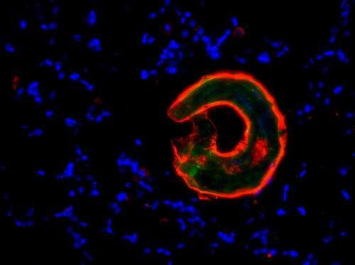 Study links common human protein to adverse parasitic worm infections