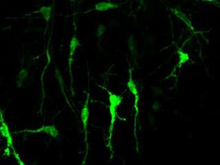 Study links epigenetic processes to the development of the cerebellar circuitry