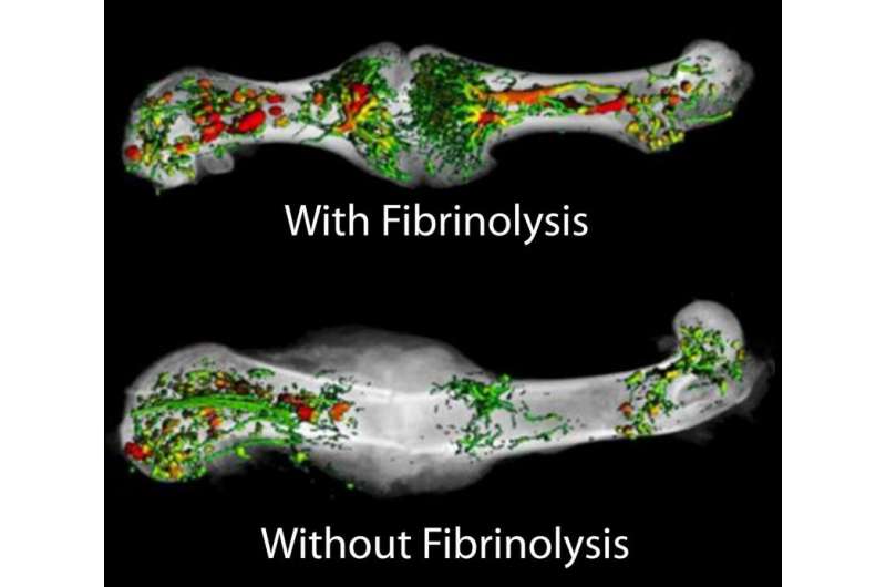 Study shifts understanding of how bone fractures heal