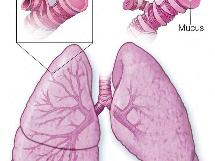 Taking less asthma medicine can be done safely with guidance Mayo Clinic study says