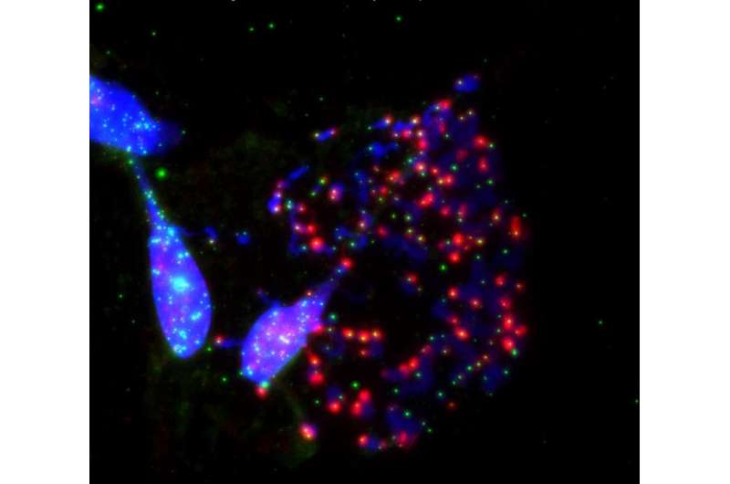 Targeting telomeres, the timekeepers of cells, could improve chemotherapy