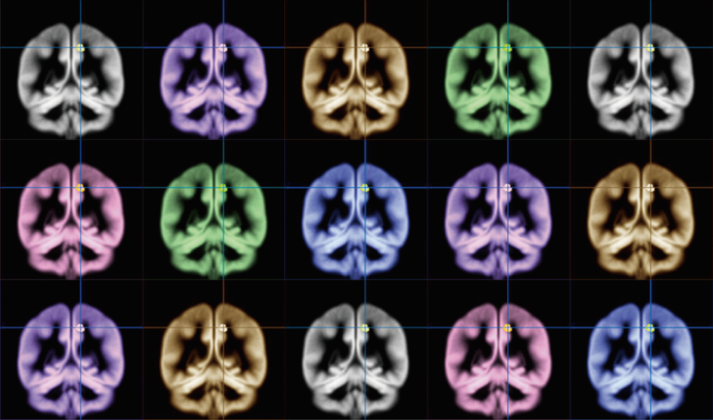 The search for happiness: Using MRI to find where happiness happens