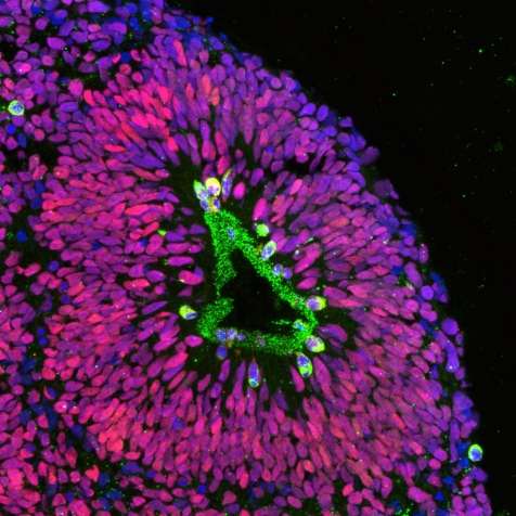 人类细胞模拟大脑的微小的球体,研究人员说