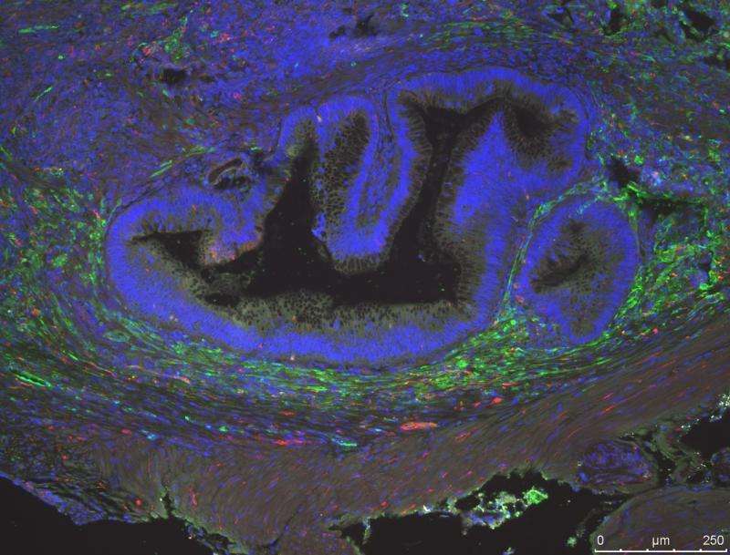 Tissue-engineered colon from human cells develop different types of neurons