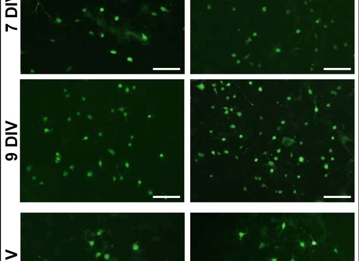 TO9 stimulates branching processes of oligodendrocytes in vitro
