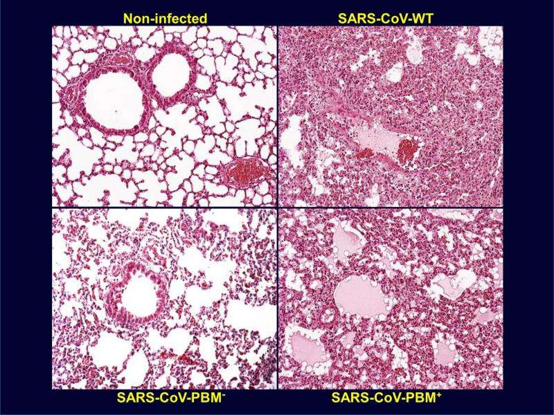 Towards a safe and efficient SARS-coronavirus vaccine: Mechanism and prevention of genetic instability of a live attenuated viru