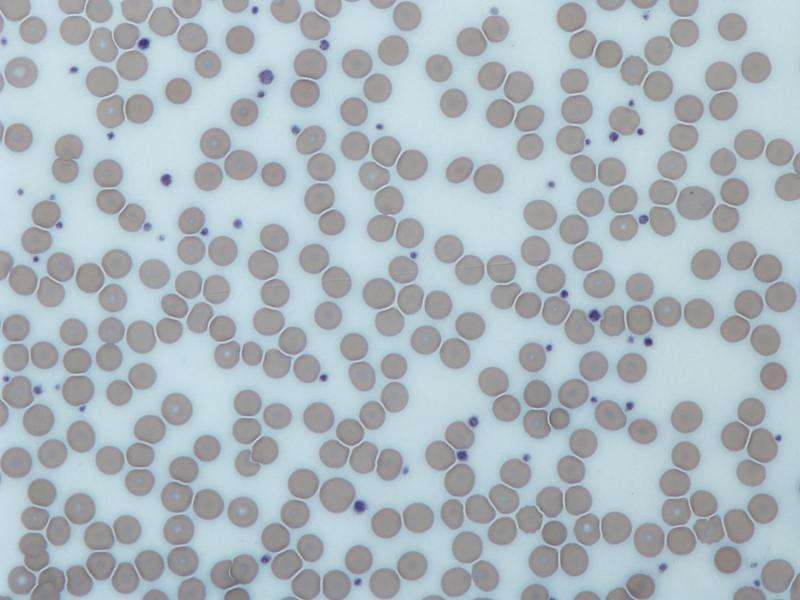 UBC researchers transform humble blood cells into 'Franken-platelets'