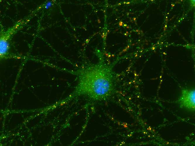 脐带细胞帮助眼睛的神经元连接