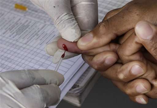 UN: HIV patients should start treatment immediately