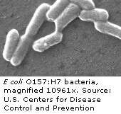 U.S. &amp;lt;i&amp;gt;E. coli&amp;lt;/i&amp;gt; O157 outbreaks mainly due to food