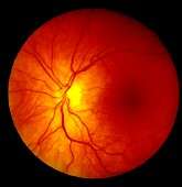 Veteran eye care clinicians use holistic image information