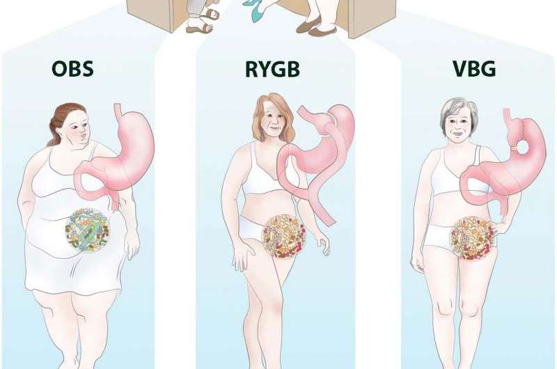Weight loss surgery benefits for gut microbiome last at least a decade