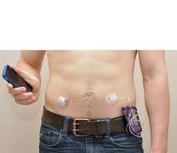 Which artificial pancreas system is the best for children with type 1 diabetes?