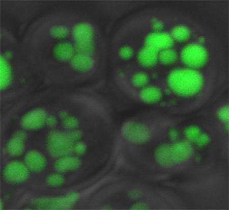 Yeast protein network could provide insights into human obesity
