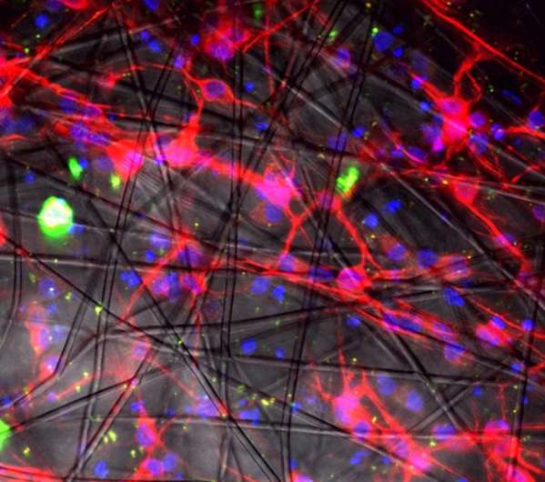 3-D technology enriches human nerve cells for transplant to brain