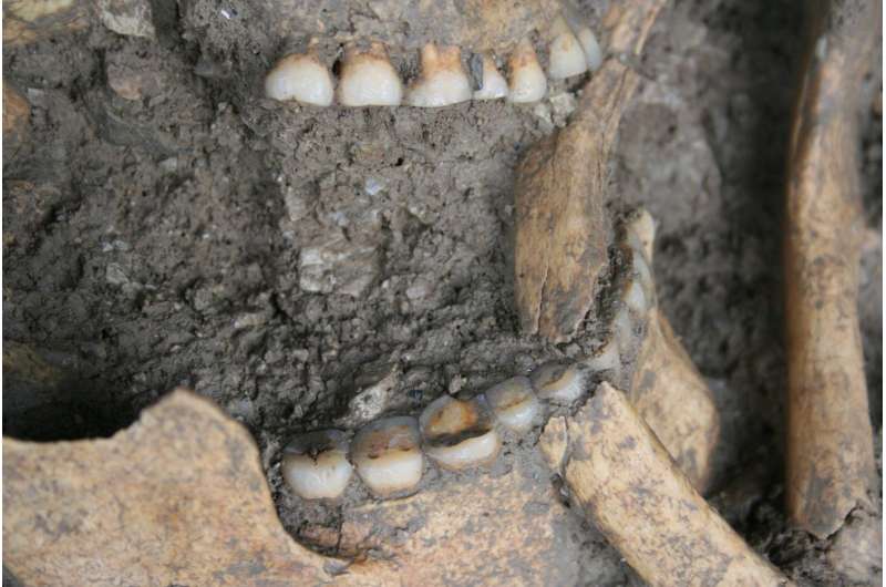 Ancient dental plaque sheds new light on the diet of Mesolithic foragers in the Balkans