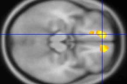 Brain scans of children with Tourette's offer clues about disorder