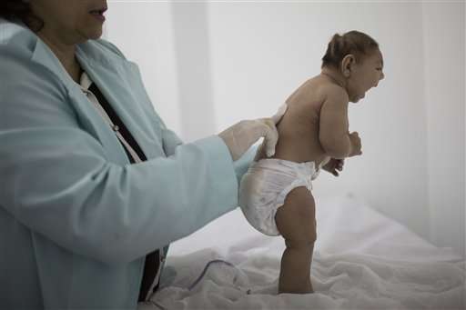 Brazil's Zika-related abortion debate sparks backlash