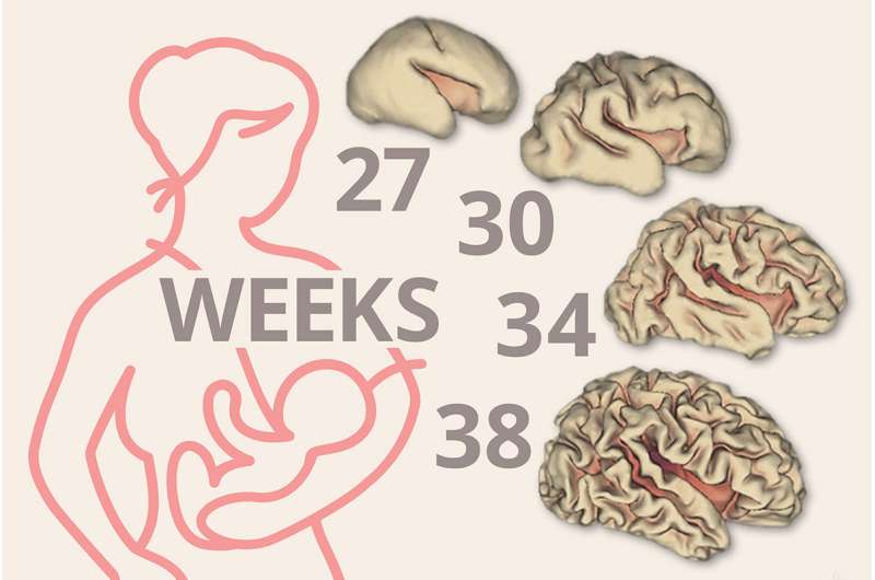 Breast milk linked to significant early brain growth in preemies