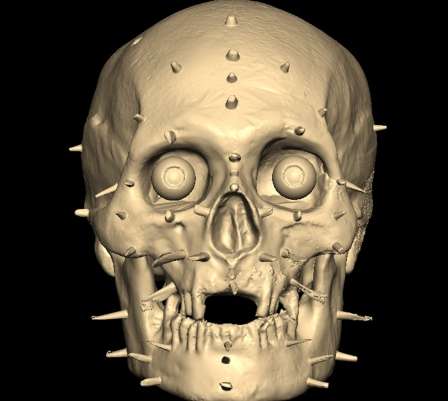 Digitally reconstructed skull and face may reveal Robert the Bruce, king-hero of the Scots