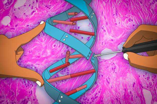 Gene therapy technique may help prevent cancer metastasis