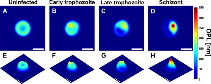Holographic imaging and deep learning diagnose malaria