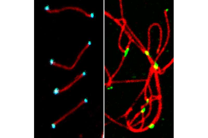 Identification of a new protein essential for ovule and sperm formation