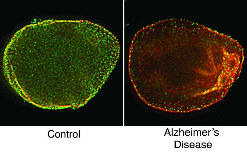 Mesh-like scaffold is disordered in Alzheimer's-affected cells
