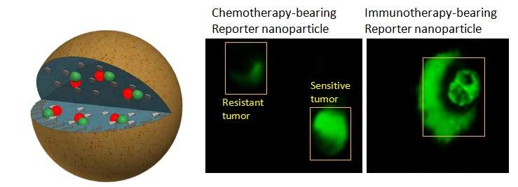 New nanoparticle reveals cancer treatment effectiveness in real time