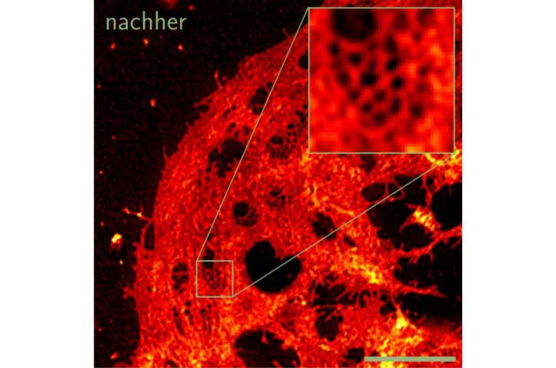 New open source software for high resolution microscopy