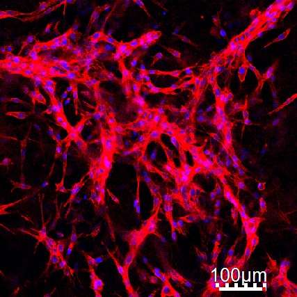 New protein gel for tissue regeneration