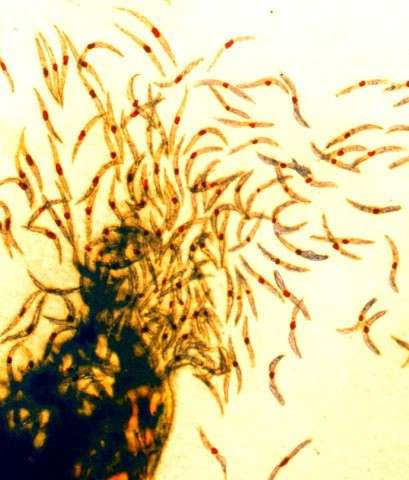 疟疾寄生虫表面发现了疫苗的新靶点