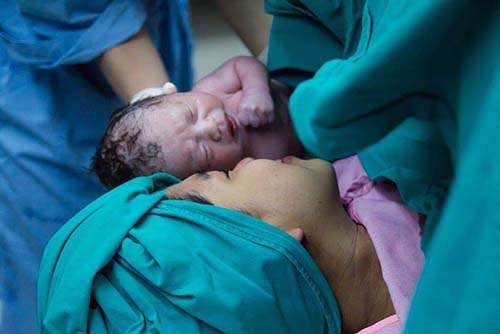 Obstetricians encourage natural childbirth to remove risks with c-section surgeries