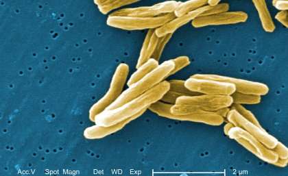 Promising new method inhibits TB–causing bacteria