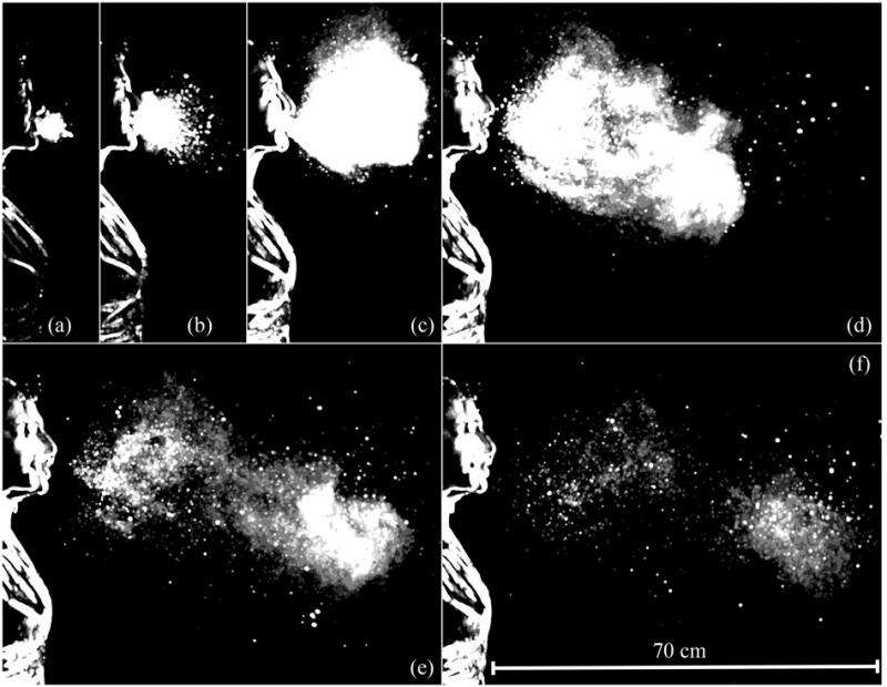 Sneezing produces complex fluid cascade, not a simple spray