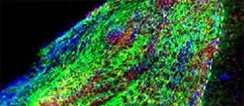 Stem cell therapy heals injured mouse brain